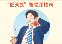 了解颈椎病的发病原因